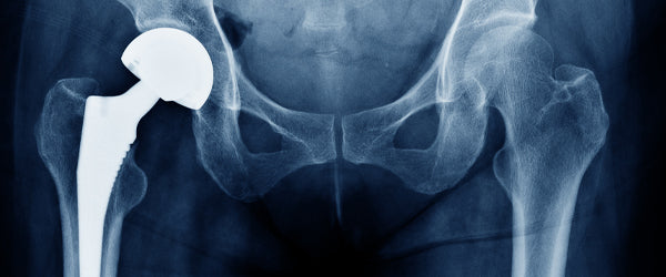 Hip Pain in Nurses: Causes, Solutions, and Prevention